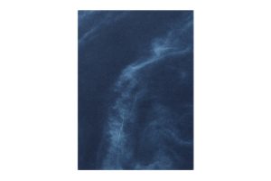 Małgorzata Stankiewicz, viridescent, afire